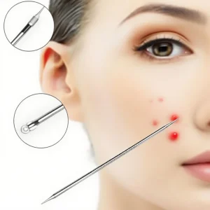 5 in 1 Professional Stainless Steel Blackhead Remover Kit Pimple Acne Needle Whitehead Blackhead Tweezer Comedone Extractor