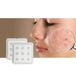 Customized Micro Needle Acne Patch Repairing Pinples with Microneedling Removal Acnes Fast and Effectively