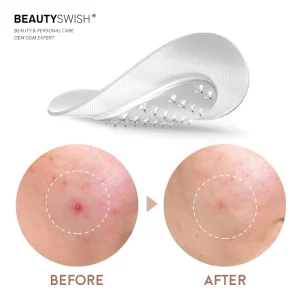Private Label Micro Needle Acne Pimple Healing Patch Invisible Hyaluronic Acid Microneedle Acne Patch for Skin Care